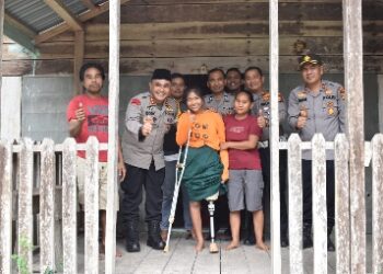 Akhirnya Julita Memiliki Kaki Palsu, Terima Kasih Pak Kapolres Inhu