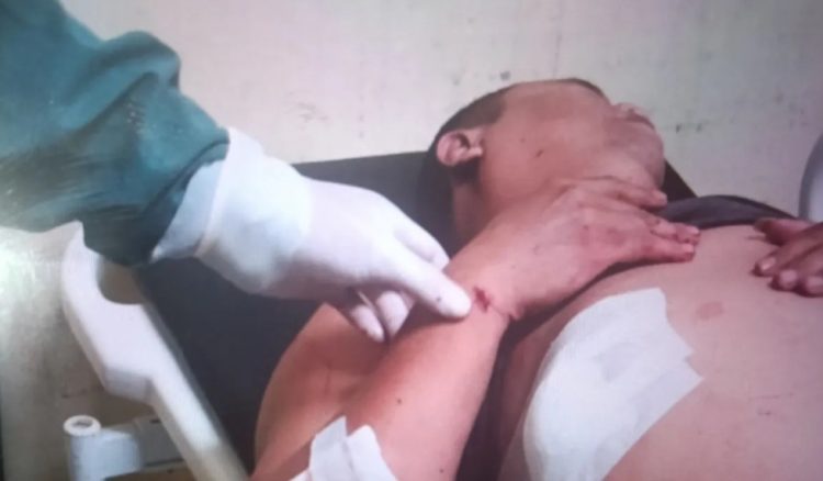 Polres Pasaman Barat Tangkap Pelaku Penusukan